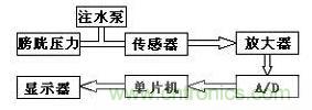 大牛漫談：腹腔壓力動(dòng)態(tài)測量儀的原理解析