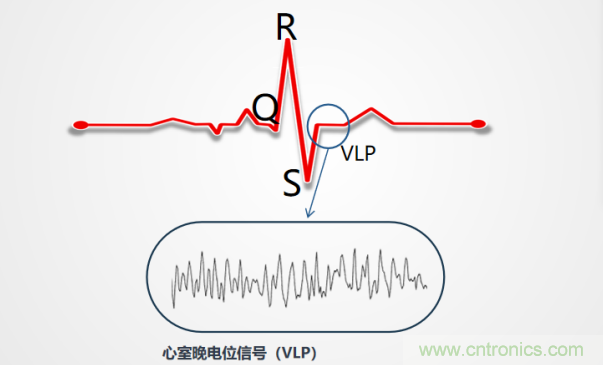 解決心電監(jiān)測行業(yè)難題，曼森伯格的濾波技術(shù)獲國家知識產(chǎn)權(quán)局發(fā)明授權(quán)